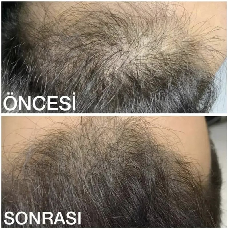 HAMİYET GÜZELLİK SALONU